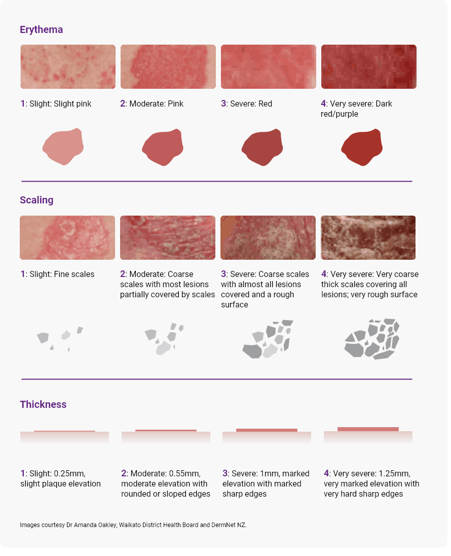 erythema_desktop